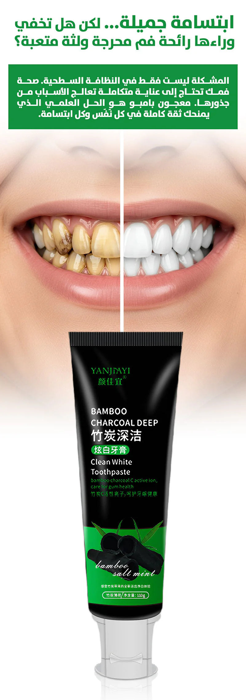 💕معجون الأسنان رقم 1 سنة 2025 - حصريا متوفر في الجزائر❤️💕